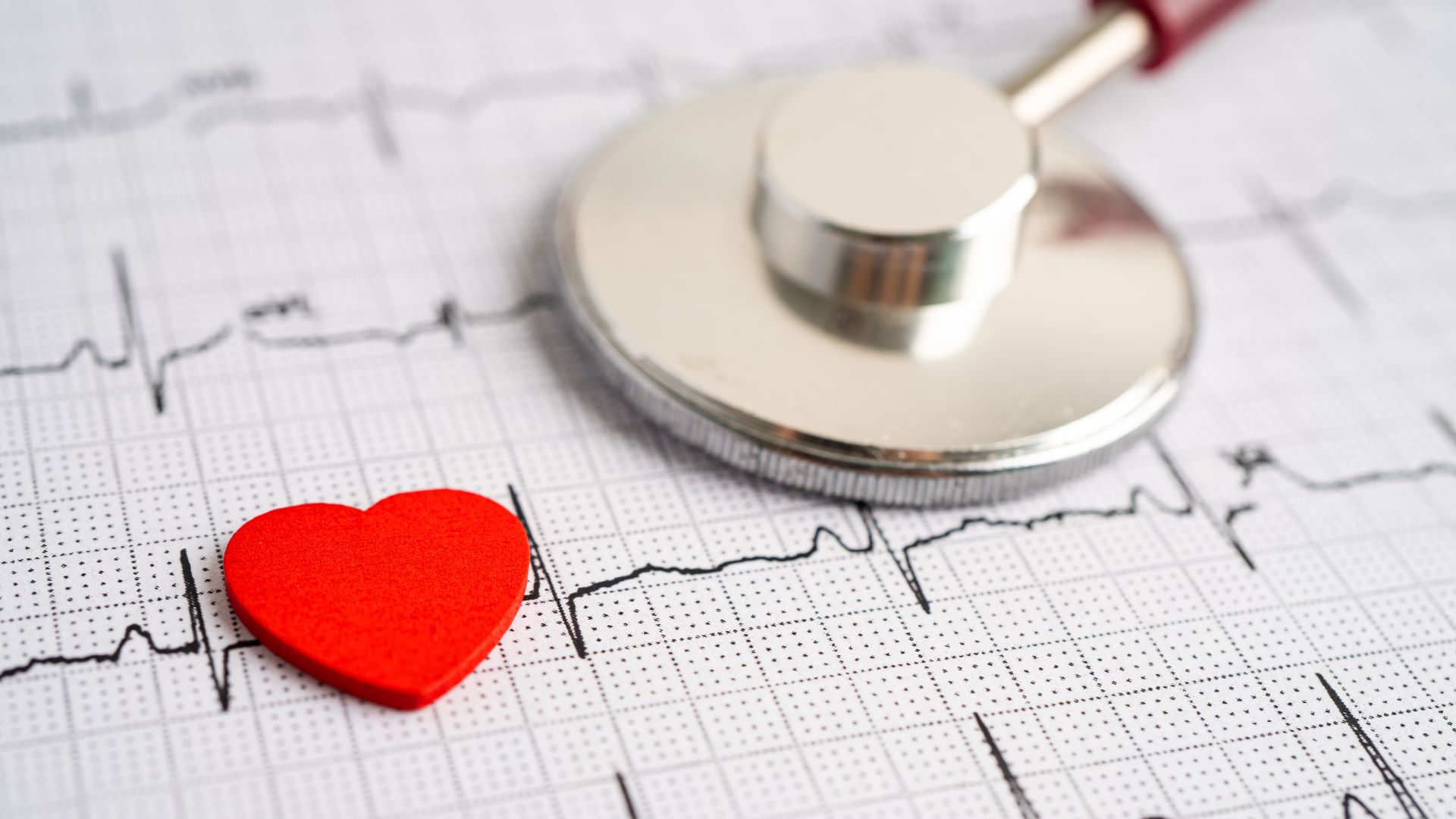 Exame de Eletrocardiograma Entenda o que ele pode revelar sobre seu coração