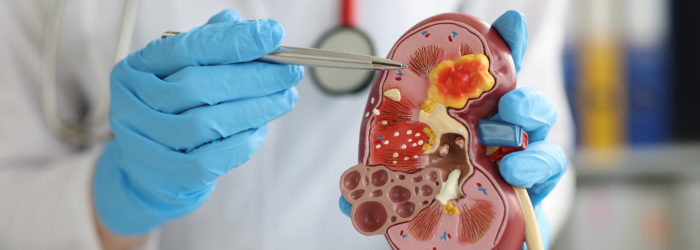 Doenças Valvares Cardiologista explica sinais que você não deve ignorar