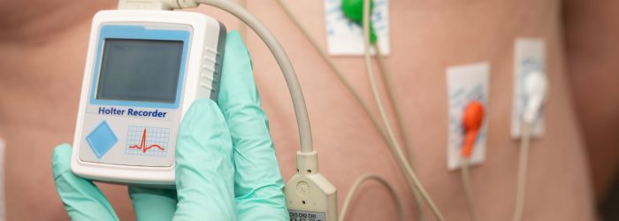 Exame de Holter 24 horas Cardiologista explica o que esperar do seu monitoramento