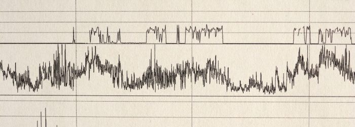 Exame de Polisonografia Entenda para que serve e quando fazer