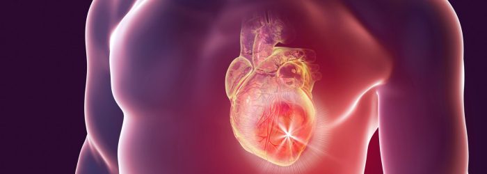 Sintomas de Infarto Cardiologista revela sinais que você não deve ignorar